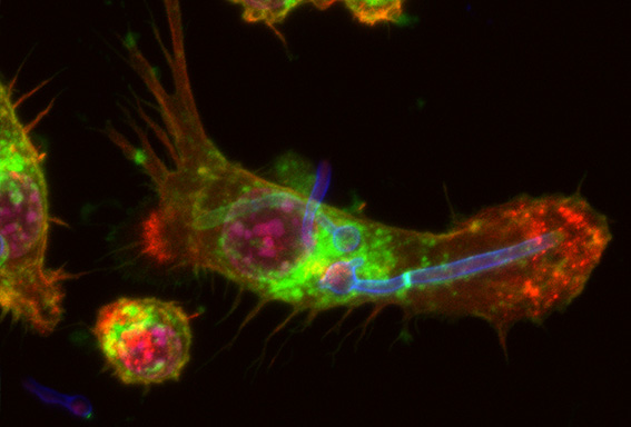 Virulence mechanisms research image
