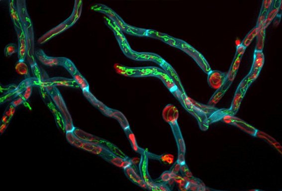 Virulence mechanisms research image